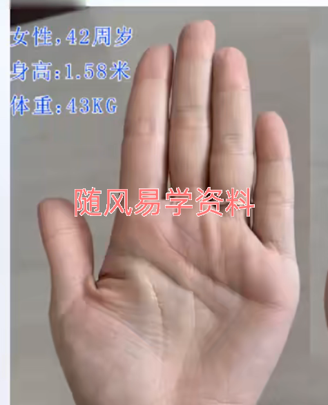 掌纹医学23集视频
